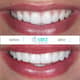 Slider image (10) MBT Dental Pro